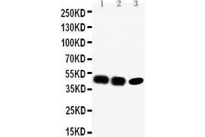 Anti-CCR6 antibody, Western blotting Lane 1: Rat Liver Tissue Lysate Lane 2: SW620 Cell Lysate Lane 3: CEM Cell Lysate (CCR6 anticorps  (C-Term))