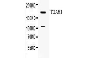 Western blot analysis of TIAM1 expression in MCF-7 whole cell lysates ( Lane 1). (TIAM1 anticorps  (C-Term))