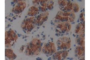 DAB staining on IHC-P; Samples: Human Stomach Tissue