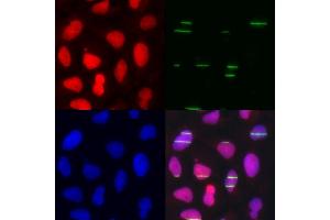 Immunofluorescence analysis of U2OS cells using POLE3 antibody (ABIN5973867).