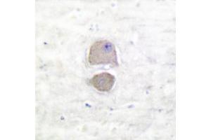 Image no. 1 for anti-BCL2-Associated X Protein (BAX) antibody (ABIN265325) (BAX anticorps)