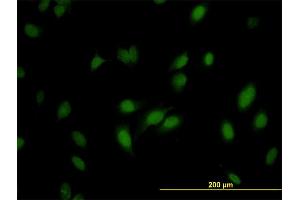 Immunofluorescence of monoclonal antibody to RNMT on HeLa cell.
