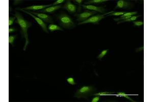 Immunofluorescence of purified MaxPab antibody to TRADD on HeLa cell.