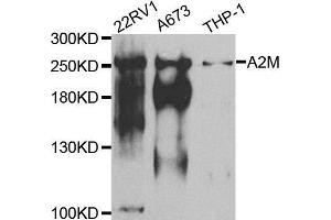 Western blot analysis of extracts of various cell lines, using A2M antibody.