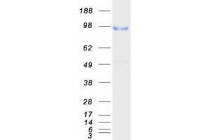 Validation with Western Blot