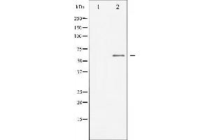 Western blot analysis of Dab1 expression in HepG2 whole cell lysates,The lane on the left is treated with the antigen-specific peptide. (DAB1 anticorps  (Internal Region))