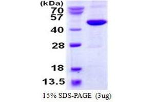 Image no. 1 for Methionyl Aminopeptidase 1 (METAP1) protein (His tag) (ABIN1098259) (METAP1 Protein (His tag))