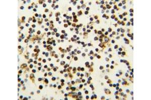 IHC analysis of FFPE human lymph tissue stained with NPM1 antibody