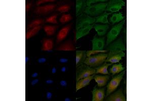 ABIN7094440 and ABIN7098488 staining  cells by IF/ICC. (Tenascin N anticorps  (C-Term))