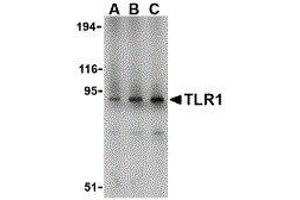 Western Blotting (WB) image for anti-Toll-Like Receptor 1 (TLR1) (N-Term) antibody (ABIN2479707) (TLR1 anticorps  (N-Term))