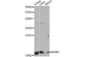 Western blot analysis of extracts of various cell lines, using MANF Antibody. (MANF anticorps  (AA 25-182))