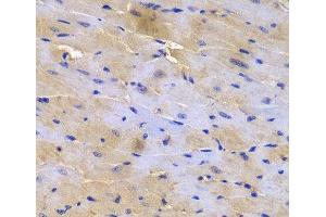 Immunohistochemistry of paraffin-embedded Mouse heart using SGCE Polyclonal Antibody at dilution of 1:200 (40x lens). (SGCE anticorps)