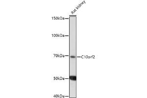 Western blot analysis of extracts of Rat kidney, using C10orf2 antibody (ABIN6129358, ABIN6137715, ABIN6137717 and ABIN6220923) at 1:1000 dilution. (C10orf2 anticorps  (AA 385-684))
