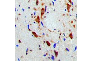 Immunohistochemical analysis of SMG7 staining in human brain formalin fixed paraffin embedded tissue section. (SMG7 anticorps  (Center))