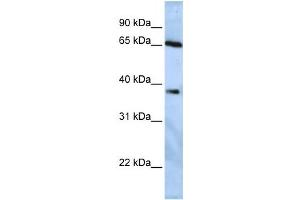 Western Blotting (WB) image for anti-Ubiquitin Specific Peptidase 3 (USP3) antibody (ABIN2458037) (USP3 anticorps)