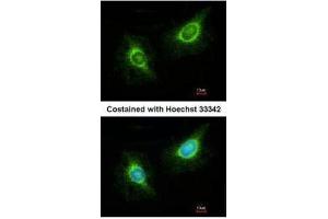 ICC/IF Image Immunofluorescence analysis of methanol-fixed HeLa, using Laminin beta 3, antibody at 1:200 dilution.
