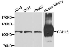 Western blot analysis of extracts of various cell lines, using CDH16 antibody. (Cadherin-16 anticorps)