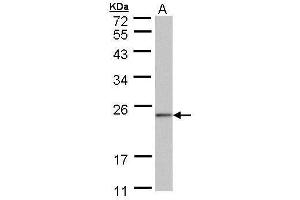 WB Image Sample (30 ug of whole cell lysate) A: 293T 12% SDS PAGE antibody diluted at 1:1000