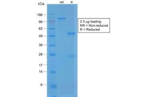 SDS-PAGE analysis of purified, BSA-free recombinant vWF antibody (clone VWF/1859R) as confirmation of integrity and purity.