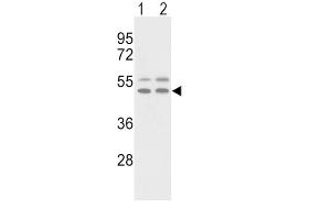 Western Blotting (WB) image for anti-Vitronectin (VTN) antibody (ABIN3003231) (Vitronectin anticorps)