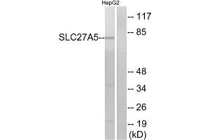 Western Blotting (WB) image for anti-Solute Carrier Family 27 (Fatty Acid Transporter), Member 5 (SLC27A5) (Internal Region) antibody (ABIN1850922) (SLC27A5 anticorps  (Internal Region))