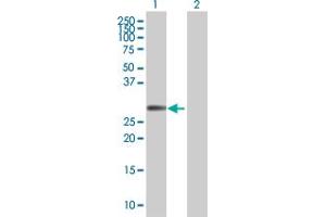 Lane 1: FHL1 transfected lysate ( 31. (FHL1 293T Cell Transient Overexpression Lysate(Denatured))