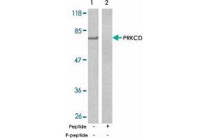 Western blot analysis of extract from MCF-7 cells using PRKCD polyclonal antibody  . (PKC delta anticorps)