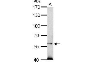 WB Image SOCS5 antibody detects SOCS5 protein by Western blot analysis.