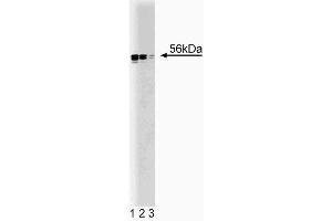 Western blot analysis of Lyn on HEL (human erythroleukemia cell line) lysate. (LYN anticorps  (AA 1-138))