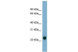 WB Suggested Anti-AK3 Antibody Titration: 0. (Adenylate Kinase 3 anticorps  (N-Term))