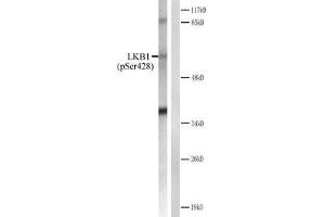 Western blot analysis of extracts from CV-1 cells treated with forsklin. (LKB1 anticorps  (pSer428))