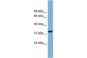 Human OVCAR-3; WB Suggested Anti-OR6C68 Antibody Titration: 0. (OR6C68 anticorps  (N-Term))