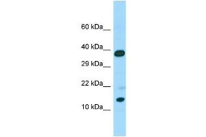 Host: Rabbit Target Name: CALML6 Sample Type: Placenta lysates Antibody Dilution: 1. (CALML6 anticorps  (C-Term))