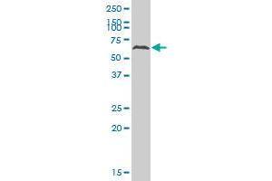 ATP6AP1 polyclonal antibody (A01), Lot # 051207JC01 Western Blot analysis of ATP6AP1 expression in HeLa .