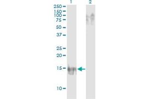 Western Blot analysis of APOB expression in transfected 293T cell line by APOB monoclonal antibody (M14), clone 3E5. (APOB anticorps  (AA 28-127))