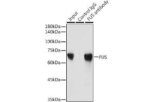 Immunoprecipitation analysis of 300 μg extracts of Jurkat cells using 3 μg FUS antibody (ABIN6127938, ABIN6140818, ABIN6140819 and ABIN7101788).