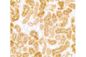 Immunohistochemistry (IHC) image for anti-Dipeptidyl-Peptidase 4 (DPP4) (AA 29-766) antibody (ABIN7795690)