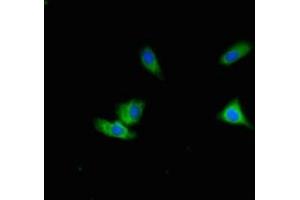 Immunofluorescent analysis of Hela cells using ABIN7150586 at dilution of 1:100 and Alexa Fluor 488-congugated AffiniPure Goat Anti-Rabbit IgG(H+L) (ALG12 anticorps  (AA 367-422))