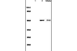 Lane 1: mouse brain lysates Lane 2: mouse liver lysates probed with Anti GCK/Glucokinase Polyclonal Antibody, Unconjugated (ABIN734558) at 1:200 in 4C.