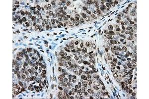 Immunohistochemical staining of paraffin-embedded colon tissue using anti-CYP1A2 mouse monoclonal antibody. (CYP1A2 anticorps)