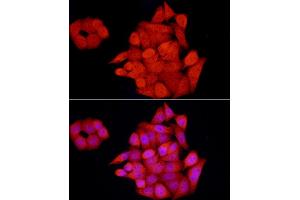Immunofluorescence analysis of HeLa cells using GCH1 Rabbit pAb (ABIN7267525) at dilution of 1:100 (40x lens). (GCH1 anticorps  (AA 1-250))