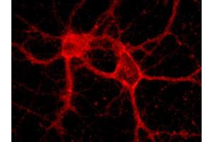 Indirect immunolabeling of hippocampus neurons (dilution 1 : 500) (Alpha-Protocadherin (AA 796-946) anticorps)