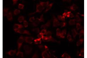 ABIN6274741 staining HepG2 by IF/ICC. (MRPL41 anticorps  (C-Term))