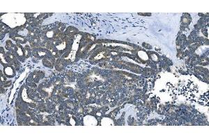 IHC analysis of eRF1/ETF1 using anti-eRF1/ETF1 antibody (ABIN7602625). (ETF1 anticorps  (AA 9-342))