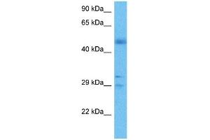 Host:  Rabbit  Target Name:  FGF2  Sample Tissue:  Human Lung Tumor  Antibody Dilution:  1ug/ml (FGF2 anticorps  (Middle Region))