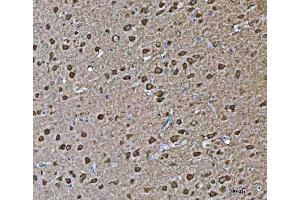 IHC analysis of VPS53 using anti-VPS53 antibody (ABIN7599731). (VPS53 anticorps  (AA 11-699))