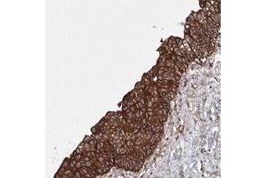 Immunohistochemical staining of human urinary bladder with SNX18 polyclonal antibody  shows strong cytoplasmic positivity in urothelial cells at 1:20-1:50 dilution. (SNX18 anticorps)