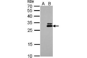 WB Image KLK7 antibody detects KLK7 protein by Western blot analysis. (Kallikrein 7 anticorps)