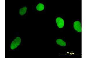 Immunofluorescence of purified MaxPab antibody to NOSIP on HeLa cell. (NOSIP anticorps  (AA 1-301))