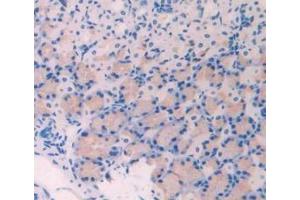 Detection of LOX in Mouse Stomach Tissue using Polyclonal Antibody to Lysyl Oxidase (LOX)